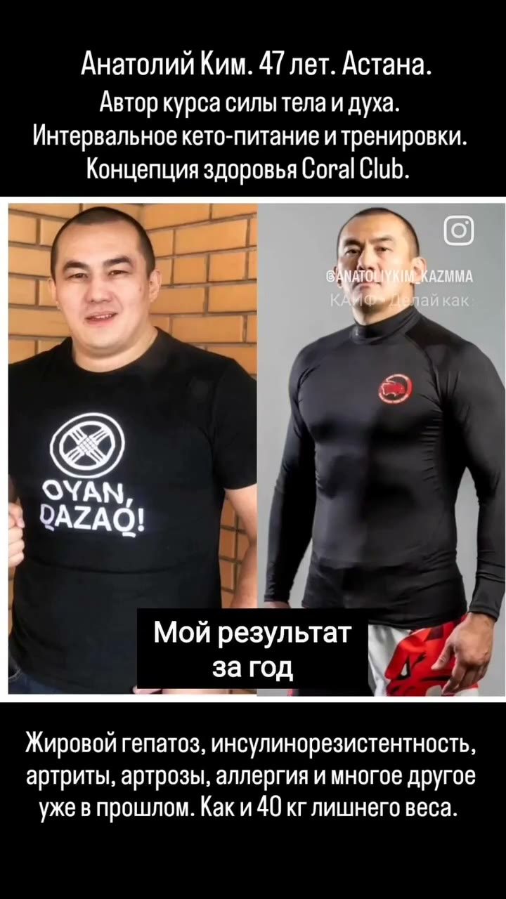 Анатолий: Минус 40 кг и никаких операций