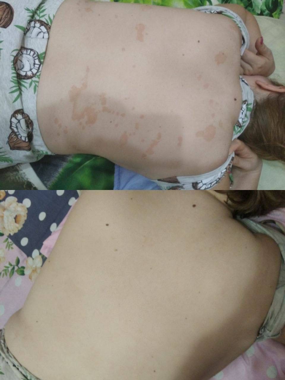Малика: Лишай 12 лет ушёл, минус 13 кг