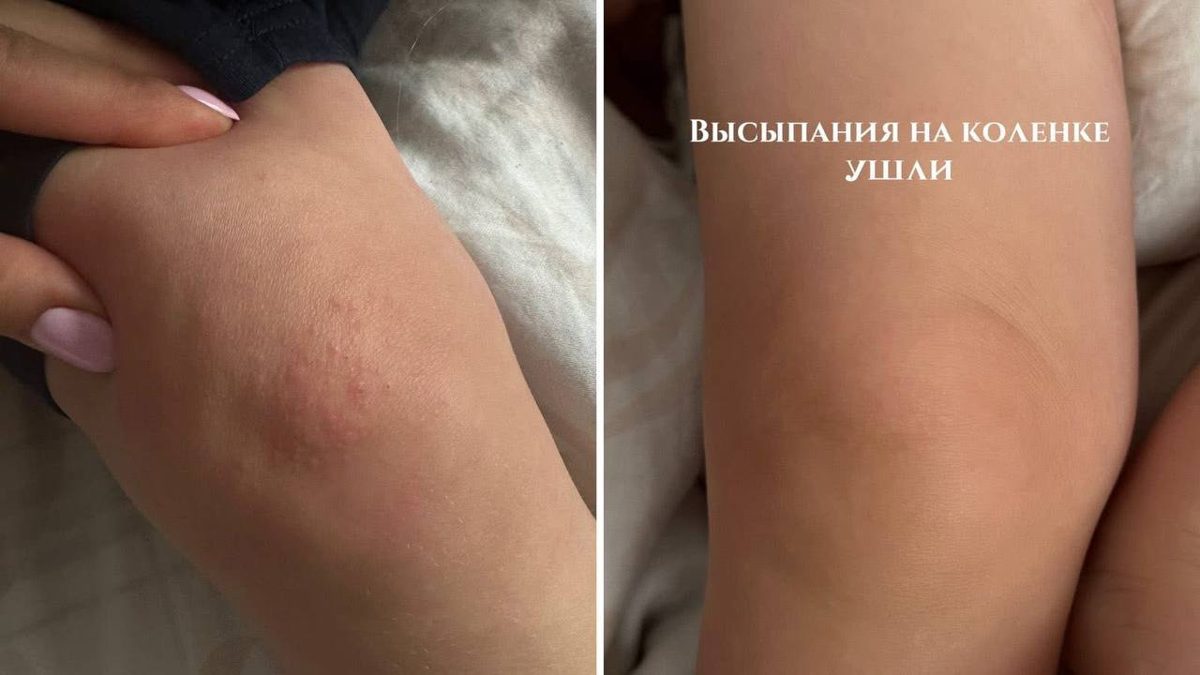 Малыш, 1 год и 3 месяца, фото 2