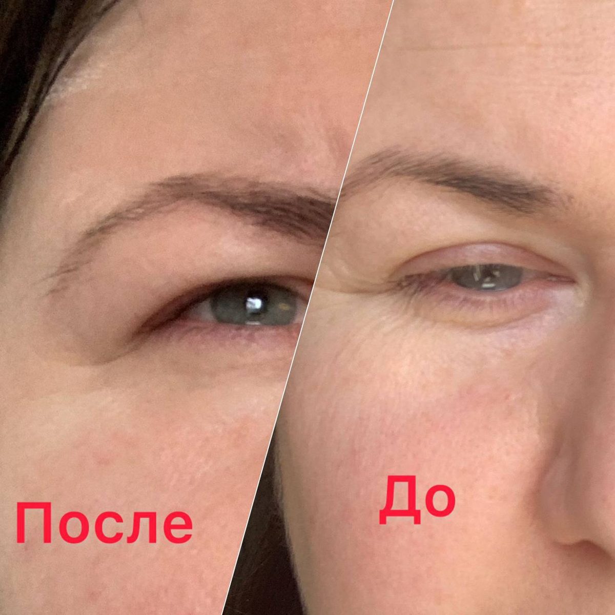 Залом на лице: Ушёл за 10 дней